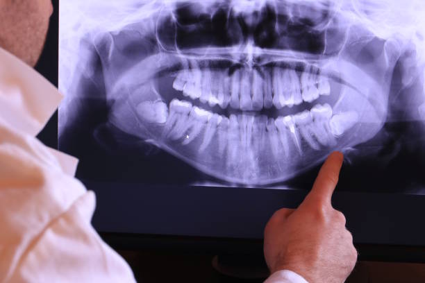 Best Emergency Dental Care for Trauma or Injury in Apple Mountain Lake, VA
