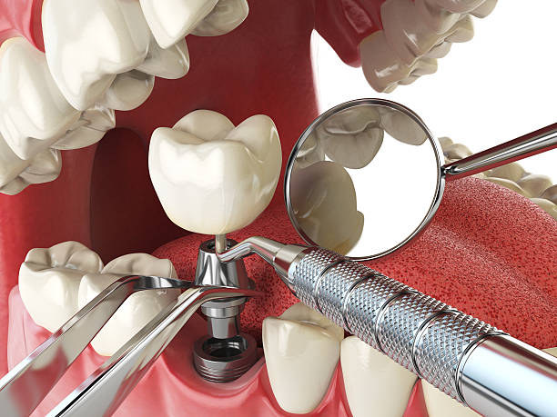  Apple Mountain Lake, VA Emergency Dentist Pros